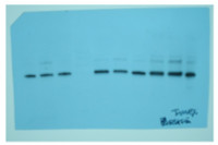 GID1c | Gibberellin receptor GID1C in the group Antibodies Plant/Algal / Hormones / Biosynthesis/regulation at Agrisera AB (Antibodies for research) (AS14 2800)